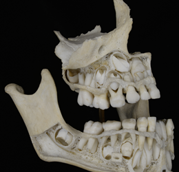 Video Conferencia: Utilidad de los Registros Odontológicos en Ciencia Forense