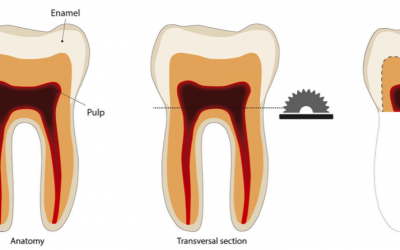 Analysis of 14 C in teeth to estimate the year of birth in the Mexican population